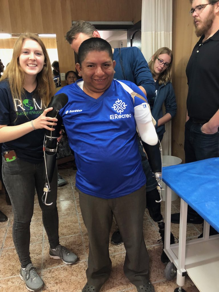 CSU student pictured with double-amputee wearing prosthetic implants.
