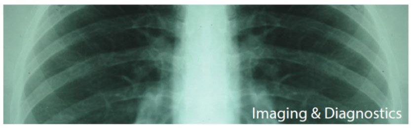 Lung image.