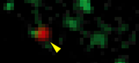 Trafficking of Membrane Protens